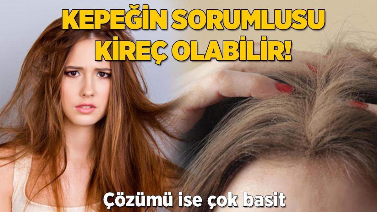 Saç tellerine yapışan kepeklere kesin çözüm! Sebebi kireç, böyle yok edin