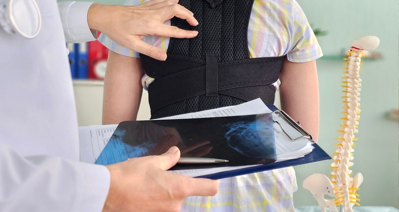 Skolyoz teşhisi koyulanlar dikkat: Bu egzersizler hayatınızı değiştirebilir
